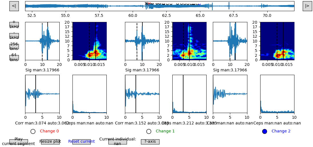 IPI_of_ELIOT-8ans-20190318-NaN-R093C010_1903133ZS02-SONY_F55.png